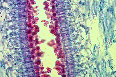 نمونه زیر میکروسکوپ بیولوژی